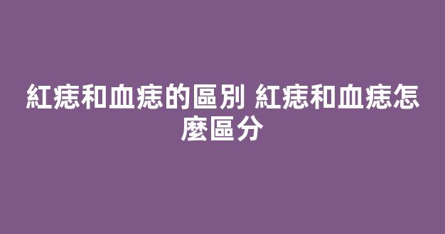 紅痣和血痣的區別 紅痣和血痣怎麼區分